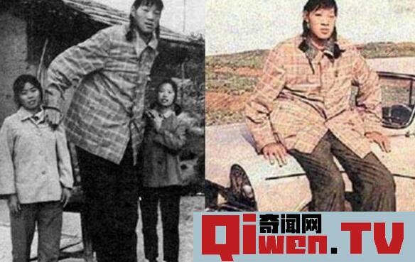 世界上最高的女性 曾金蓮 身高2.48米 只活了18歲