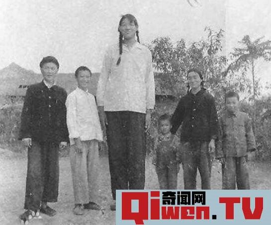 世界上最高的女性 曾金蓮 身高2.48米 只活了18歲